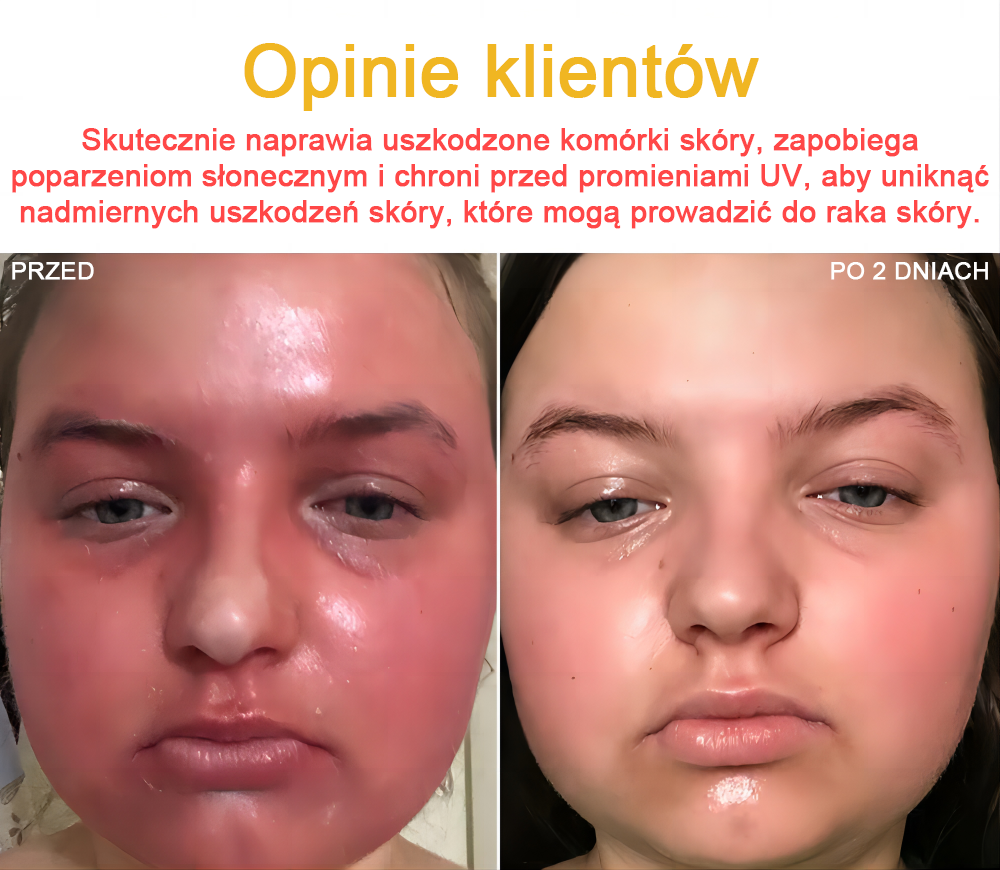[𝐎𝐟𝐢𝐜𝐣𝐚𝐥𝐧𝐲 𝐬𝐤𝐥𝐞𝐩 𝐟𝐥𝐚𝐠𝐨𝐰𝐲] 𝑩𝑺𝑾𝑬𝑳𝑳® Krem z jadami pszczół 👨‍⚕️ Zalecane gorąco przez Polskie Towarzystwo Dermatologiczne🐝