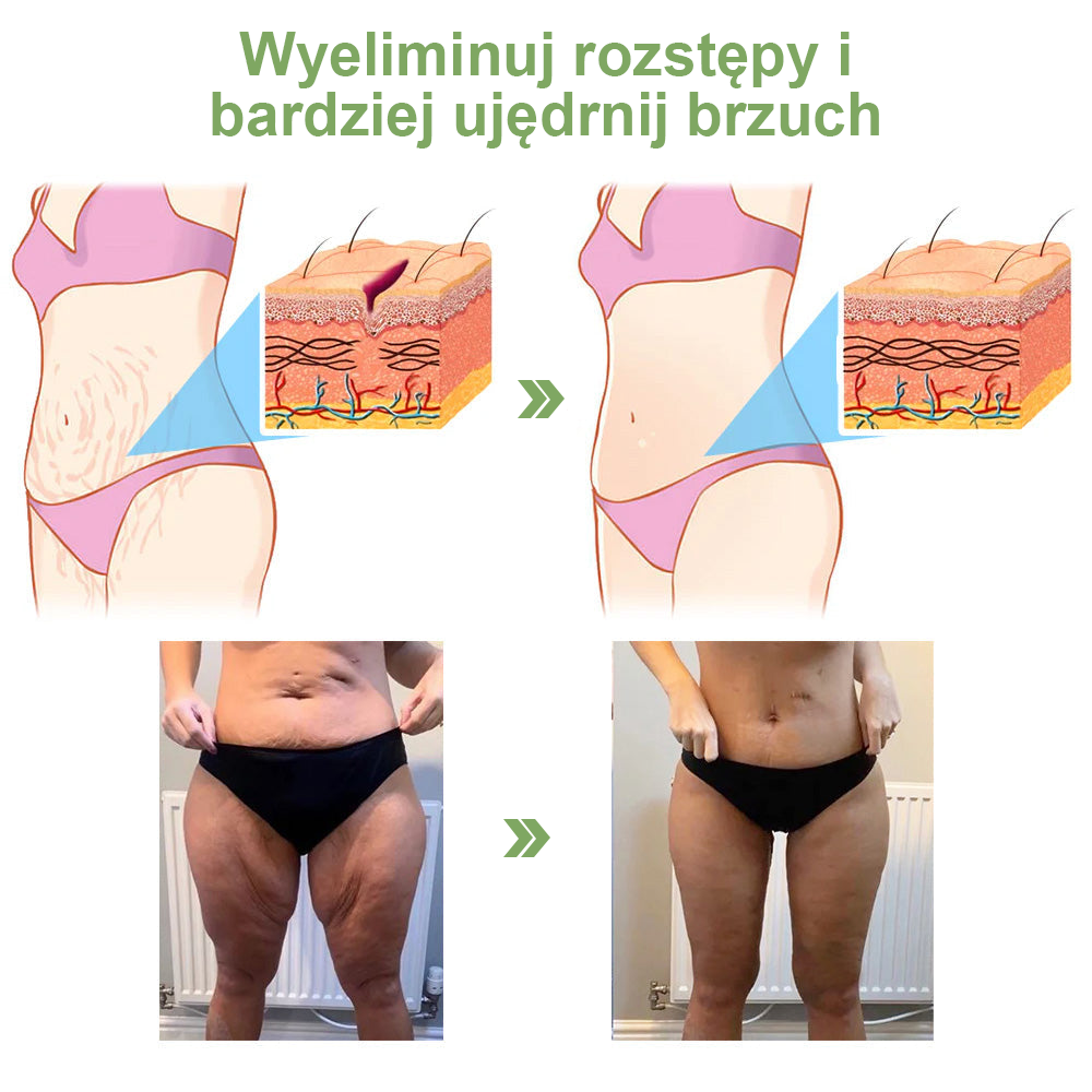 STDEI™ 💝 Luksusowy krem ujędrniający z kolagenem (🔥70% zniżki na ograniczony czas!)