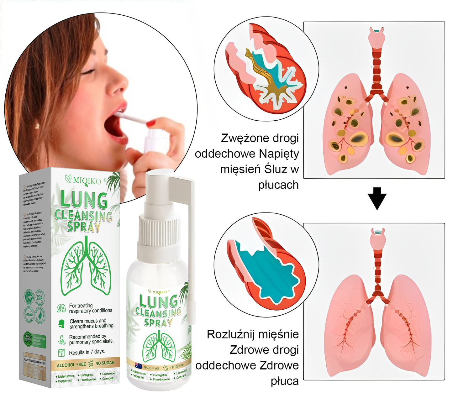 [Oficjalny flagowy sklep marki]👨‍⚕️MIQIKO® Zaawansowany spray oczyszczający płuca (☘️zalecany przez specjalistów od płuc☘️)