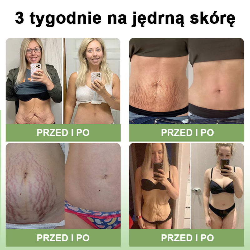 STDEI™ 💝 Luksusowy krem ujędrniający z kolagenem (🔥70% zniżki na ograniczony czas!)