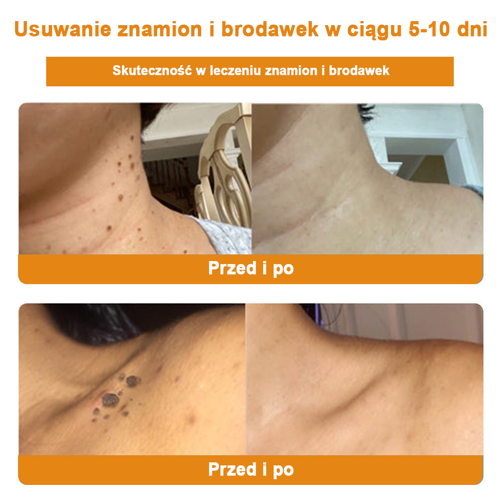 [𝐎𝐟𝐢𝐜𝐣𝐚𝐥𝐧𝐲 𝐬𝐤𝐥𝐞𝐩 𝐟𝐥𝐚𝐠𝐨𝐰𝐲] 𝑩𝑺𝑾𝑬𝑳𝑳® Krem z jadami pszczół 👨‍⚕️ Zalecane gorąco przez Polskie Towarzystwo Dermatologiczne🐝