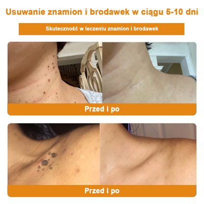 [𝐎𝐟𝐢𝐜𝐣𝐚𝐥𝐧𝐲 𝐬𝐤𝐥𝐞𝐩 𝐟𝐥𝐚𝐠𝐨𝐰𝐲] 𝑩𝑺𝑾𝑬𝑳𝑳® Krem z jadami pszczół 👨‍⚕️ Zalecane gorąco przez Polskie Towarzystwo Dermatologiczne🐝