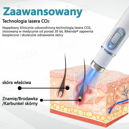 Bikenda® Nieinwazyjny Laserowy Długopis do Usuwania Pieprzyków i Brodawek