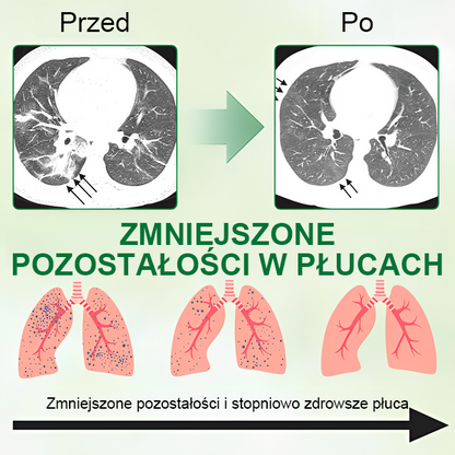 [Oficjalny flagowy sklep marki]👨‍⚕️MIQIKO® Zaawansowany spray oczyszczający płuca (☘️zalecany przez specjalistów od płuc☘️)
